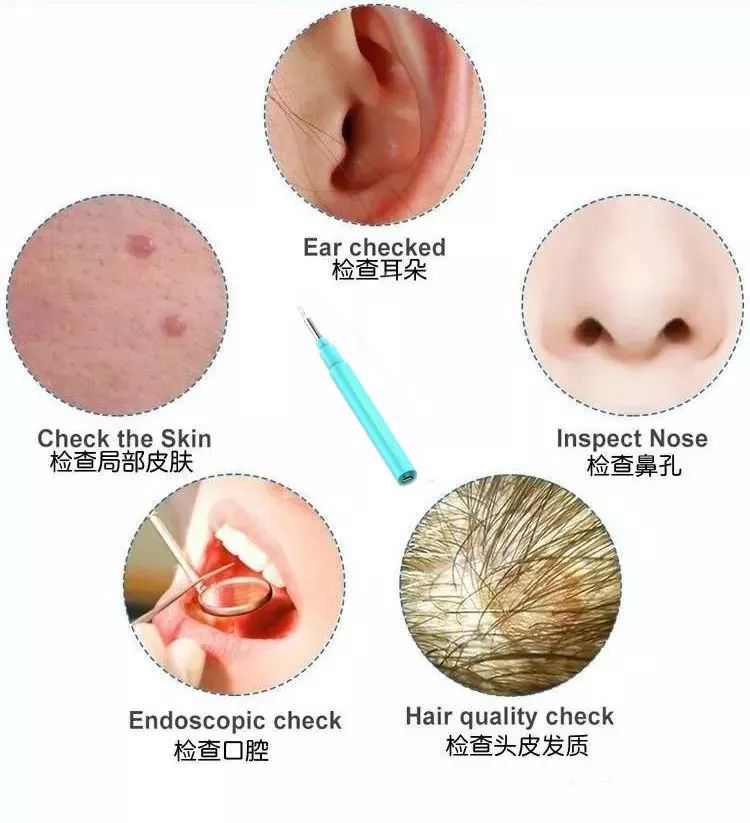 智能可視化采耳棒